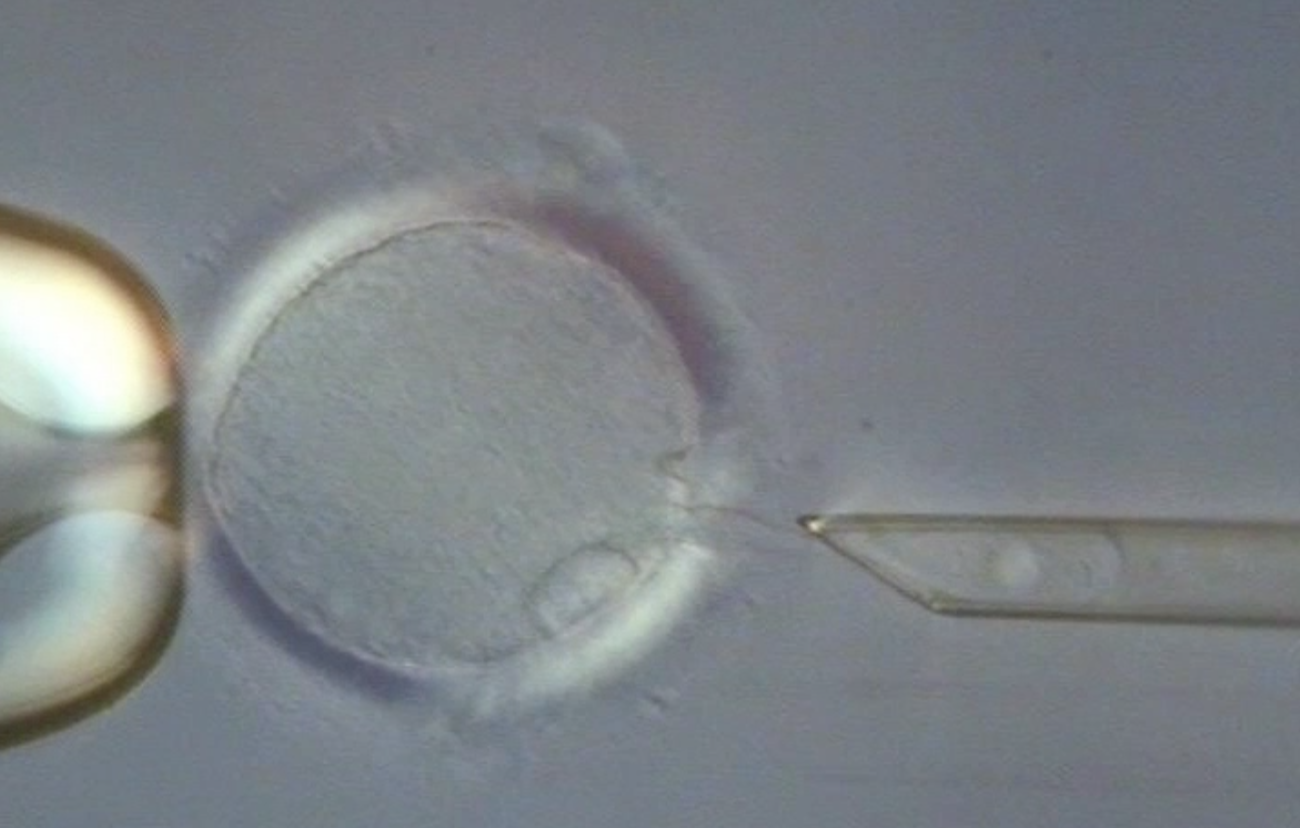 Momento de la fecundación in vitro de un óvulo